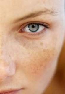 Страшная веснушка или любовь придет ко всем